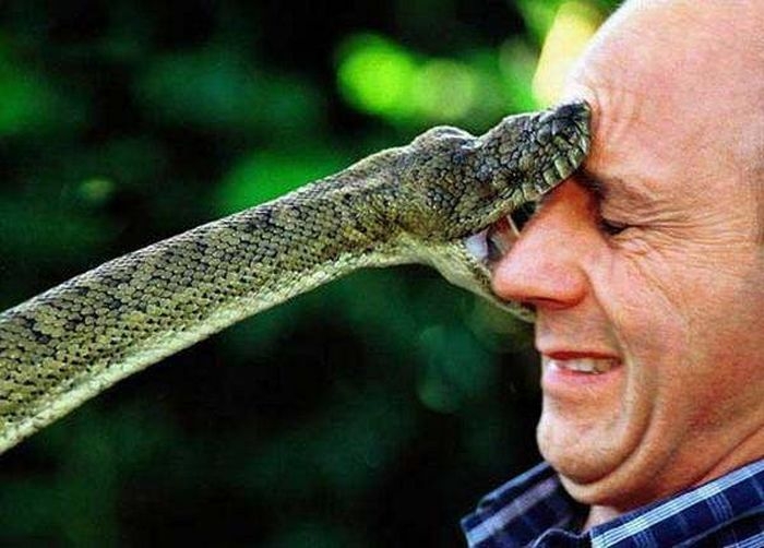 snake bite